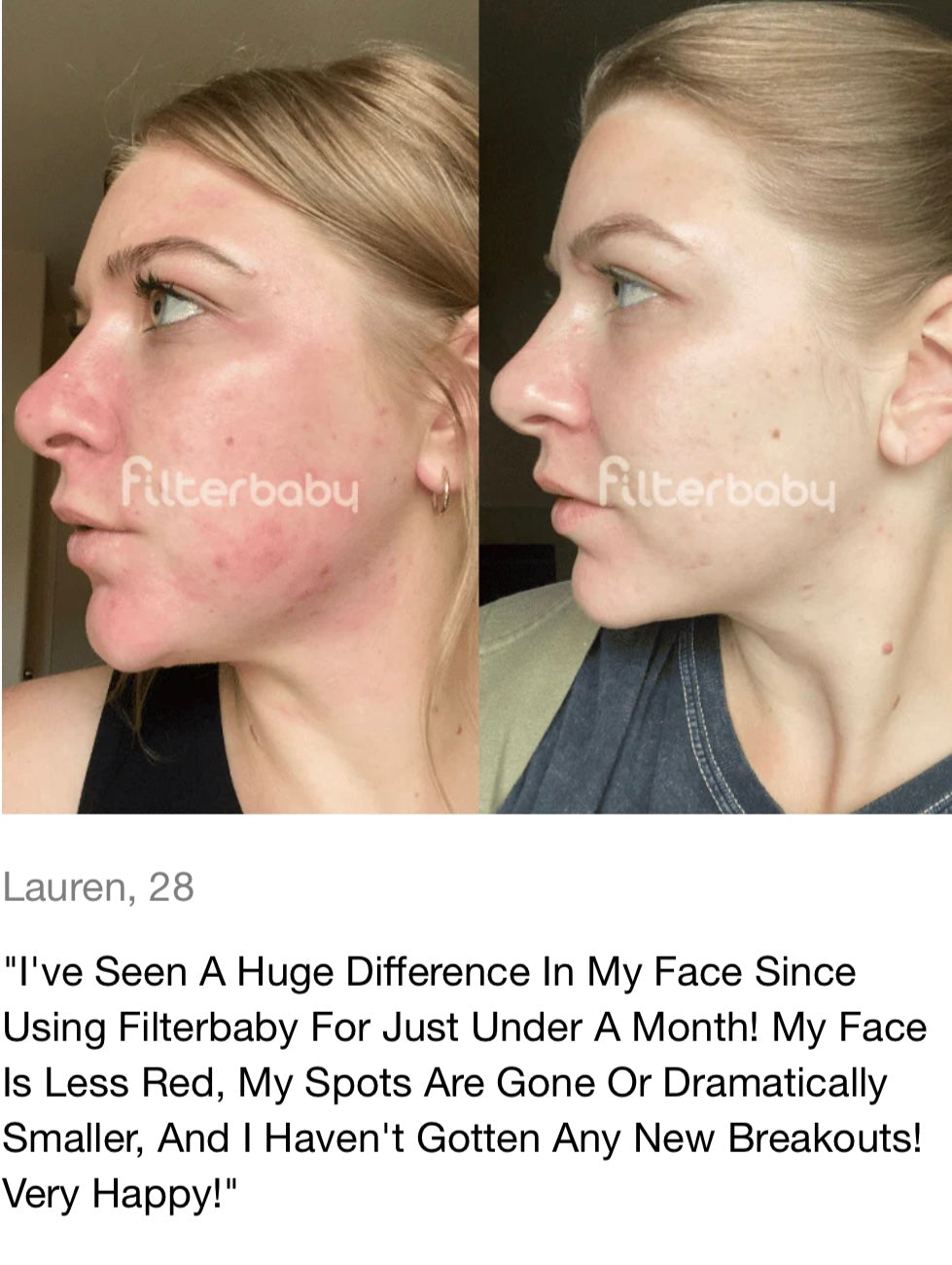 The Filterbaby